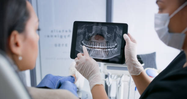 Best Emergency Root Canal Treatment in Petaluma, CA