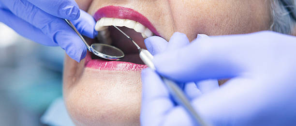 Best Pediatric Emergency Dentist in Petaluma, CA